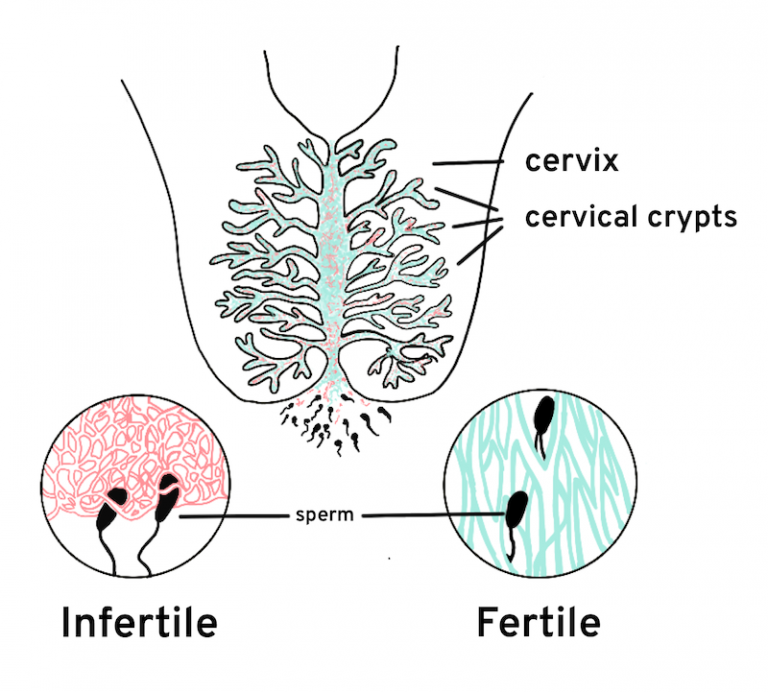 cervical mucus relationship with sperm